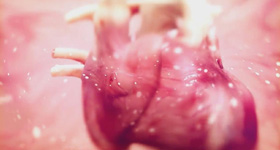 3D医学动画创作