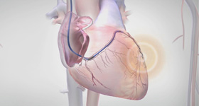 3D医学动画创作