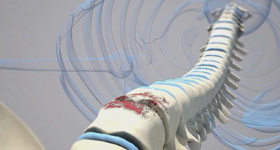 3D医学动画创作