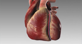 3D医学动画创作