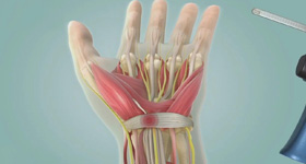 3D医学动画创作