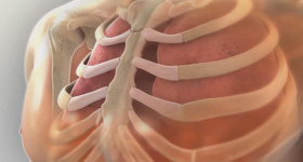 3D医学动画创作