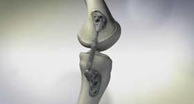 3D医学动画创作