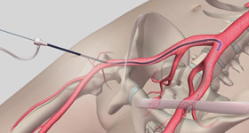 解剖及病理分析演示