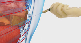解剖及病理分析演示