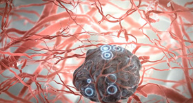 解剖及病理分析演示