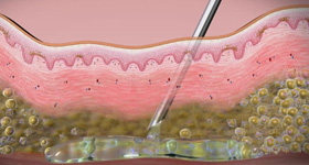 解剖及病理分析演示