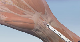 解剖及病理分析演示