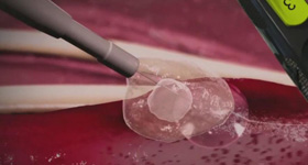 解剖及病理分析演示