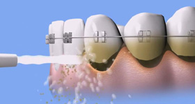 医学教学动画制作